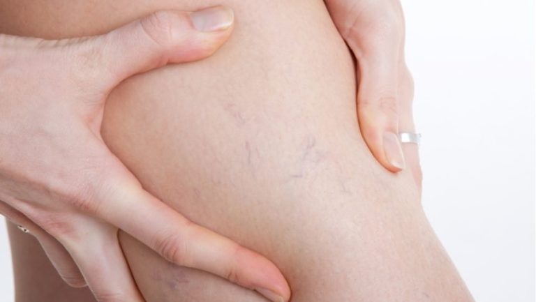 Closed-Loop SCS System Approved for Chronic Intractable Pain